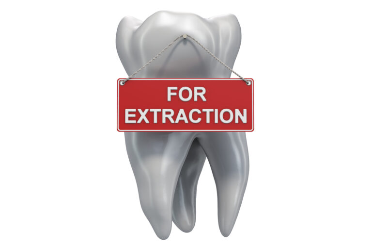 - A large, realistic tooth has a red sign hanging from it that reads "FOR EXTRACTION" in bold white letters. The design visually emphasizes the need for dental removal, likely due to decay or damage.