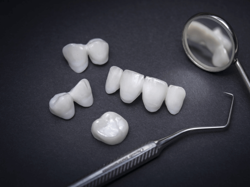 Example of various dental veneers and crowns on a table