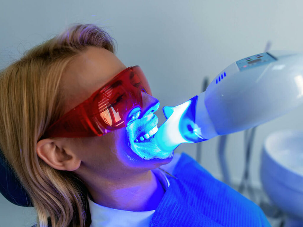 Woman receiving a laser whitening treatment